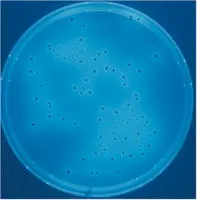 A mikrobák szulfit-redukáló clostridiumokhoz (mikrobiológia - kutatási létesítmények - élelmiszer,