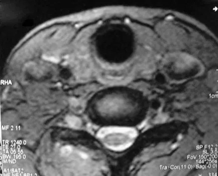 Mri щитовидната жлеза, която показва предимства и описание