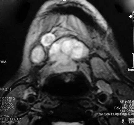 Mri щитовидната жлеза, която показва предимства и описание