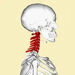 Metode de tratament neuroma spinarii si detectie