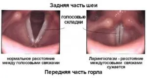 Гъди в гърлото и кашлица причинява липса