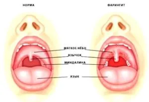 Гъди в гърлото и кашлица причинява липса