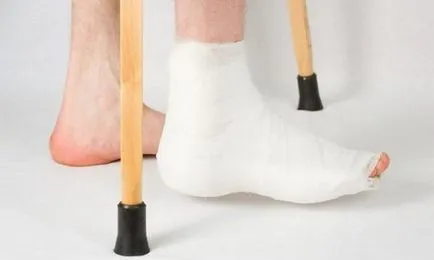 Törés a láb tünetek és a kezelés, a tünetek (videó)