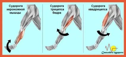 Чому зводить ноги судомою