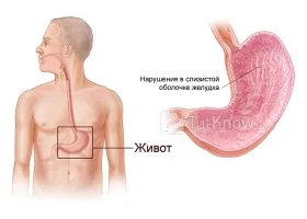 Правилното хранене за стомаха