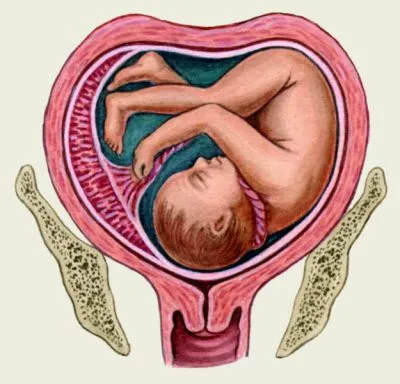 nyaki szakadás szülés közben hatások és komplikációk, kezelése és megelőzése