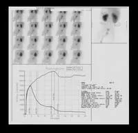 scintigrafie renală (nefrostsintigrafiya), urolog meu
