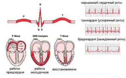 Sinus tahiaritmiile la copii, cauze de, simptome, diagnostic