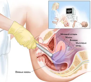 Ecografie uter si fanere tipuri de studii, rata de dimensiunea a uterului și apendicelor, când și cum să facă Uzi