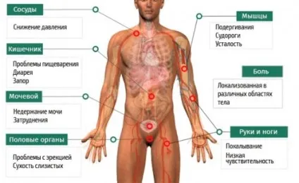 Полінейропатія верхніх і нижніх кінцівок симптоми і лікування (верхніх) Полінейропатія верхніх і нижніх кінцівок симптоми і лікування