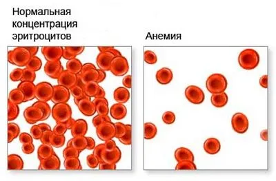 Ефектите на алкохол върху кръвни изтънява или сгъсти ефекта на алкохол в кръвта на хемоглобин и холестерол