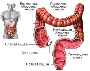 Аденокарцином на симптомите на сигмоида и лечение