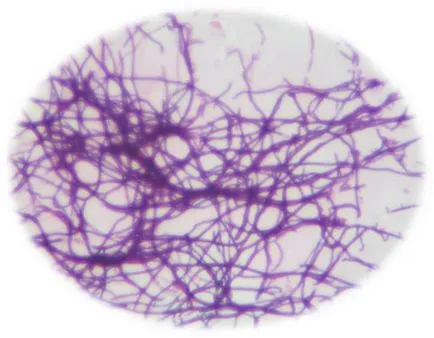 Actinomycetes szerkezete és megélhetés