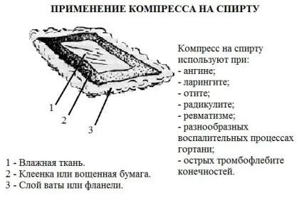 Правила накладення горілчаного компресу на горло (компресу) Правила накладення горілчаного компресу на горло