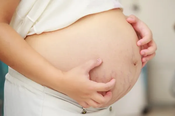 Body viszketés terhesség alatt okai és kezelése viszketés