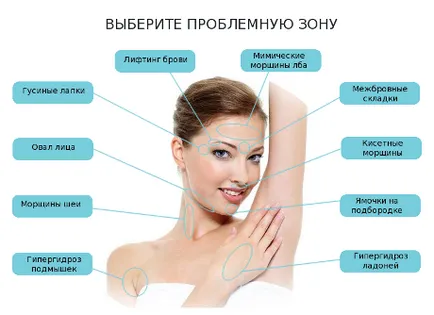 Dysport sau Botox, care mai bine și recenzii