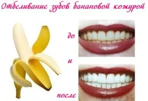 Ефективно избелване бананови кори ревюта, рецепти, съвети