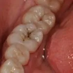 Amennyiben az alveolusok a szájban fotó választ, amire szükségük