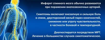 гръбначния мозък на миокарда (гръбначния, исхемична миелопатия) - това е, причинява симптоми,