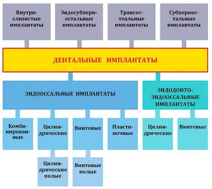 Імплантанти зубів (зубів) імплантанти зубів