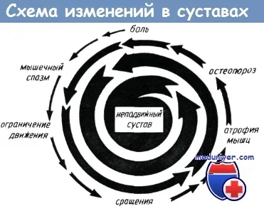 Историята на изучаването на наранявания на ръката сухожилни