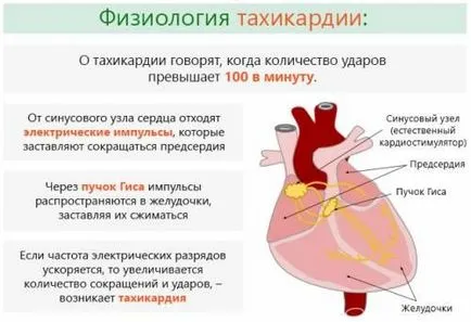 Ce fel de pastile pentru a lua cu simptome tahicardie și tratament la domiciliu