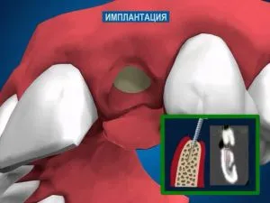 Как е индикациите венците капацитета, вида на сделката, цена