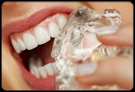 Hogyan, hogy tönkreteszi a fogakat! 19 - ásványi - módon