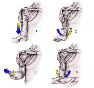 Atât la dislocarea umărului drept la