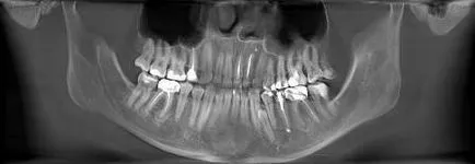 Компютърна томография на лицево-челюстната област (до