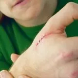 Раневая інфекція лікування, мазі - скальпель - медичний інформаційно-освітній портал (лікування) Раневая інфекція лікування, мазі - скальпель - медичний інформаційно-освітній портал