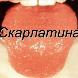 Раневая інфекція лікування, мазі - скальпель - медичний інформаційно-освітній портал (інфекція) Раневая інфекція лікування, мазі - скальпель - медичний інформаційно-освітній портал