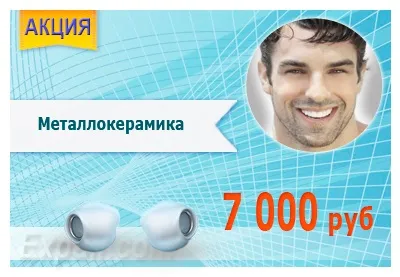 Різновиди пломб постійні, тимчасові, цементні, фотополімерні (пломб) Різновиди пломб постійні, тимчасові, цементні, фотополімерні