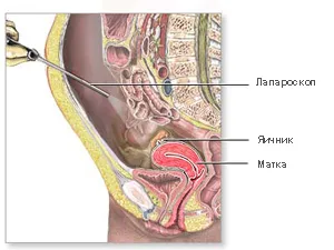 Laparoscopie, toate tipurile de costuri laparoscopie operațiunilor (495) 505-54-41