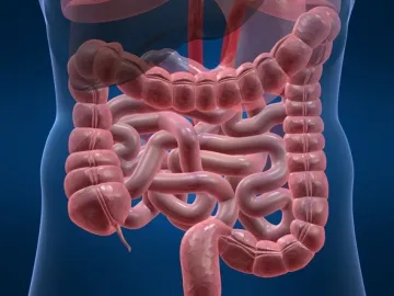 Intestinale tromboza mezenteric si modalitati de a pastra viata