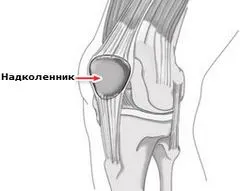 Patella - funkciók esetleges sérülések és betegségek