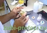 Ремонт зубних коронок варіанти, терміни, вартість (коронок) Ремонт зубних коронок варіанти, терміни, вартість