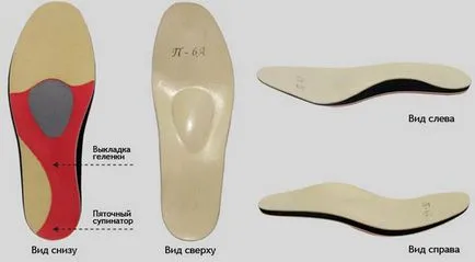 Стелки ортопедични стелки - помогне с плоски стъпала