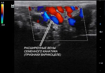 Операция Мраморно показания, Получаването се извършва, следоперативния период