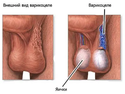 lecturi Operation Marmara, pregătire se realizează, în perioada post-operatorie