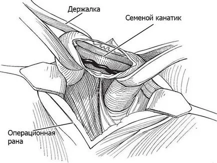 Операция Мраморно показания, Получаването се извършва, следоперативния период