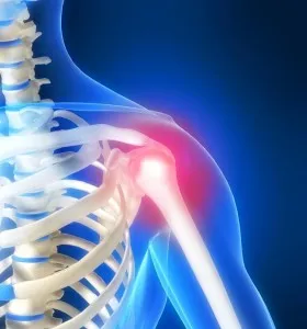 Osteoarthritis acromioclavicular közös jelei és tünetei