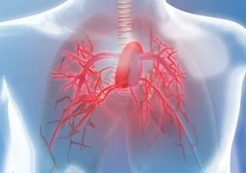 hipertensiune pulmonară primară este o boală cu consecințe grave