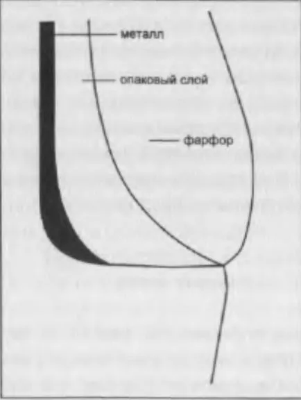 Aplicarea materialelor umăr