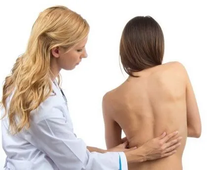 Megelőzése scoliosis rendszer események