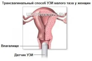 размер на матката при размери ултразвук норма, декодиране на изпълнение