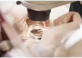 Cikkek a témában - az in vitro megtermékenyítés (IVF), az öko-blog