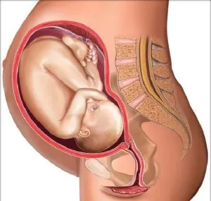 Стари плацента по време на бременност, отколкото заплашва