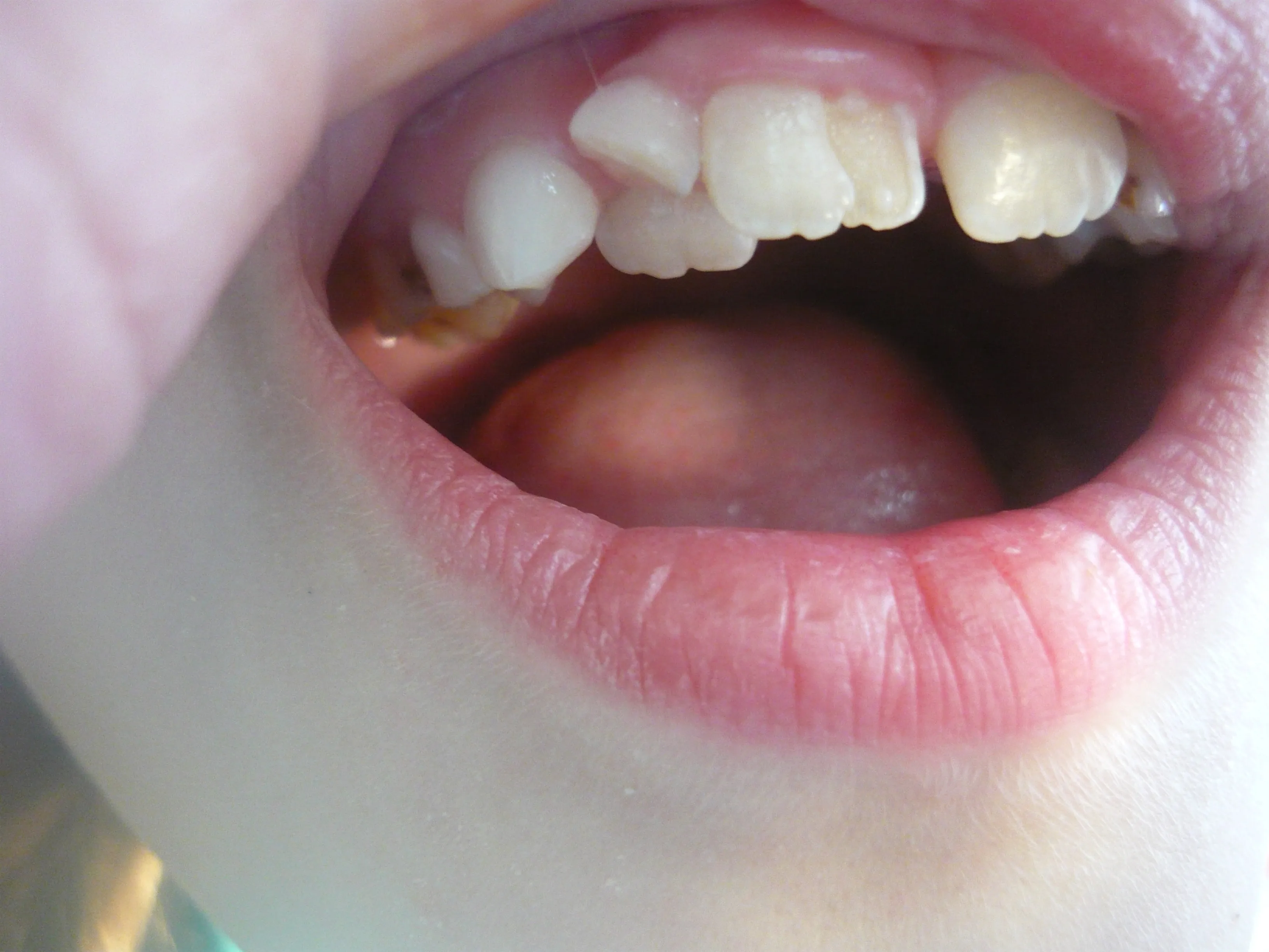 Стоматологічний журнал dental magazine 1