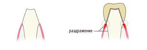 Стоматологія на кутузова (зуба яке може вмістити) Стоматологія на кутузова